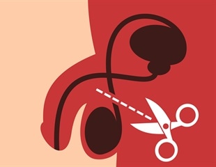 Vasectomies less likely to cause complications than expected, study shows