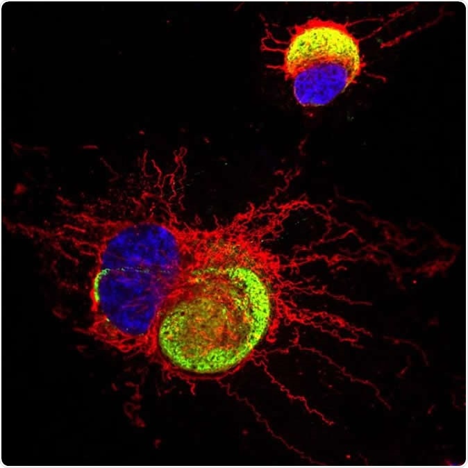 The Zika virus is highlighted in green, as the astrocyte nucleus is in blue and its cytoplasm in red. Image Credit: Karina Karmirian and Pítia Ledur