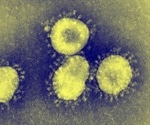 USA confirms 1st Wuhan coronavirus case