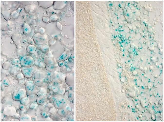These images show expression of the OPN3 gene (in blue) in white fat cells of mice in two locations. The right panel shows interscapular white adipocytes (above a layer of muscle and above brown adipose tissue). The left panel shows white adipocytes from the inguinal adipose depot. Image Credit: Cincinnati Children