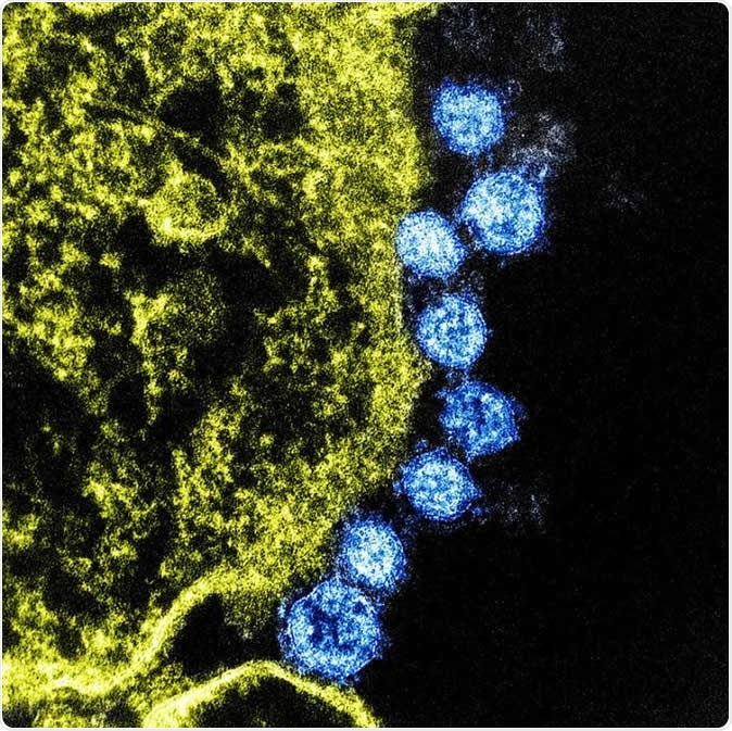 Colorized transmission electron micrograph of Middle East Respiratory Syndrome virus particles (blue) found near the periphery of an infected VERO E6 cell (yellow). Image captured and color-enhanced at the NIAID Integrated Research Facility in Fort Detrick, Maryland. Credit: NIAID