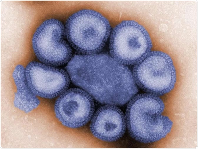 An electron micrograph of influenza virus particles. Credit: CDC