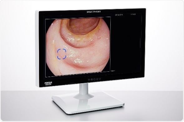 PENTAX Medical secures CE mark approval for innovative AI-assisted polyp detector