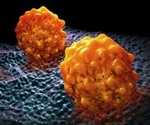 Halting metastasis by preventing cancer cells from using fat
