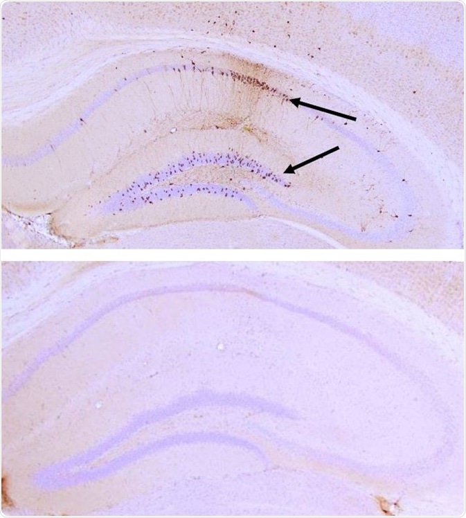 IHC analysis with AT8 of P301L mouse hippocampus after injection with P301L K18 PFFs (SPR-330) (top) and brainstem homogenate (BSH) of non-Tgmice (bottom). AT8 (pSer202/pThr205) tau antibody shows tangle-like inclusions in PFF-injected mice (top) but not in negative control (bottom)