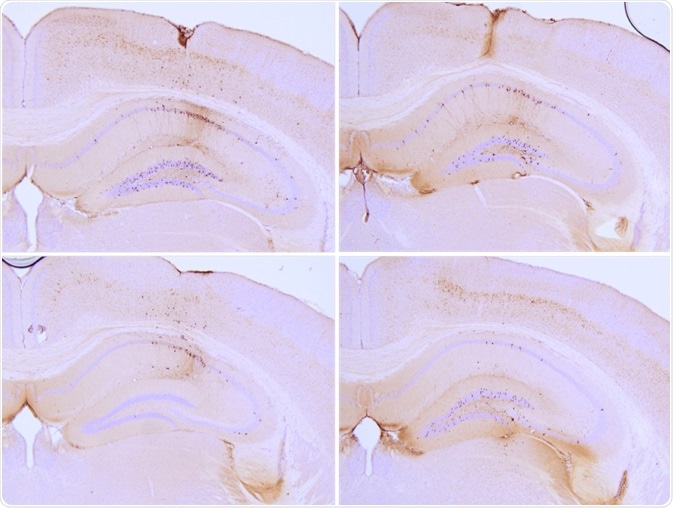 Immunohistochemistry analysis of P301L mouse hippocampus injected with K18 P301L tau PFFs (SPR-330) shows seeding of tau pathology at injection site. AT8 (pSer202/pThr205) tau antibody shows tangle-like inclusions. Experiments performed at reMYND N.V.