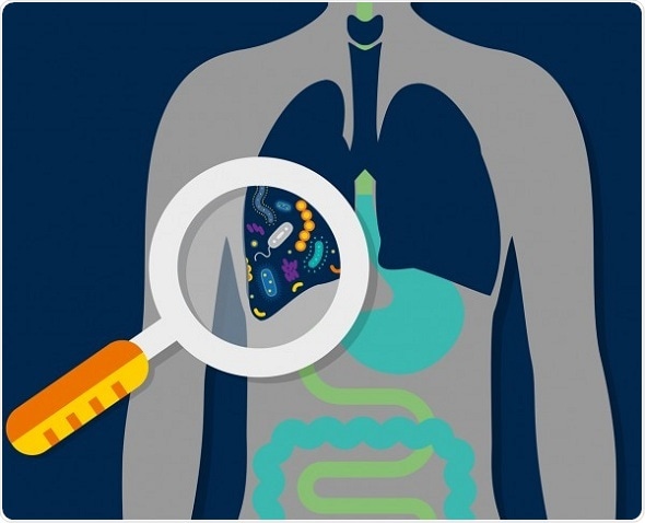 Lung microbiome of critically ill patients is predictive of clinical outcomes