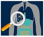 Lung microbiome of critically ill patients is predictive of clinical outcomes