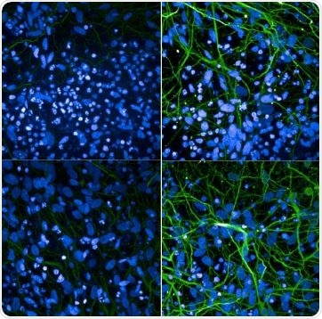 ICC/IF analysis of iPSC-derived cortical neurons from non-demented control sample (L) and individual with a P301L MAPT mutation (R) using StressMarq Clone AH36 pSer202/pThr205 tau antibody (SMC-601) and ThermoFisher Clone AT8 pSer202/pThr205 tau antibody.