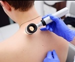 New melanoma test may better predict recurrence and improve patient care