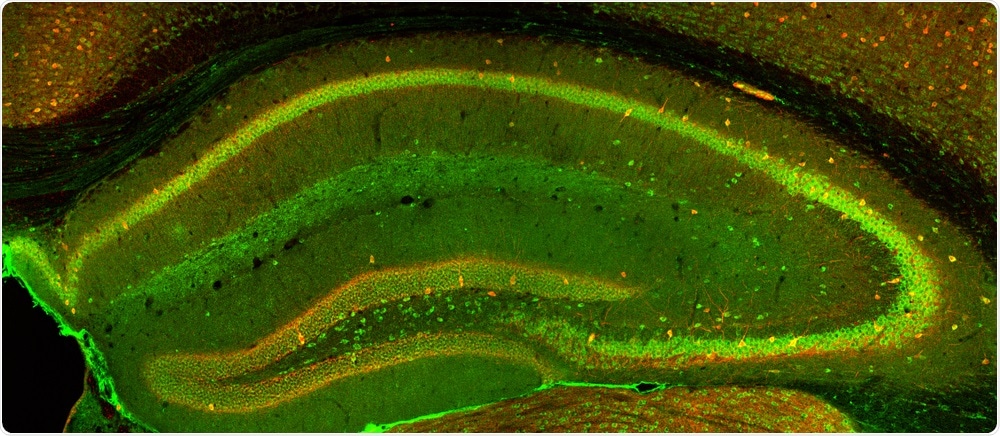 Hippocampus shown by microscope