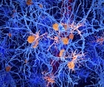 Specific group of immune cells may influence Alzheimer’s disease