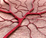 Blood vessels in women age quicker than men's