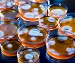 The challenge of new antibiotic discovery