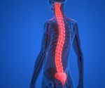 Treating Spinal Cord Injuries Using Nanoparticles