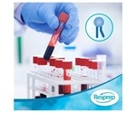 Resprep PLR SPE products can help remove both phospholipids and proteins in a single procedure