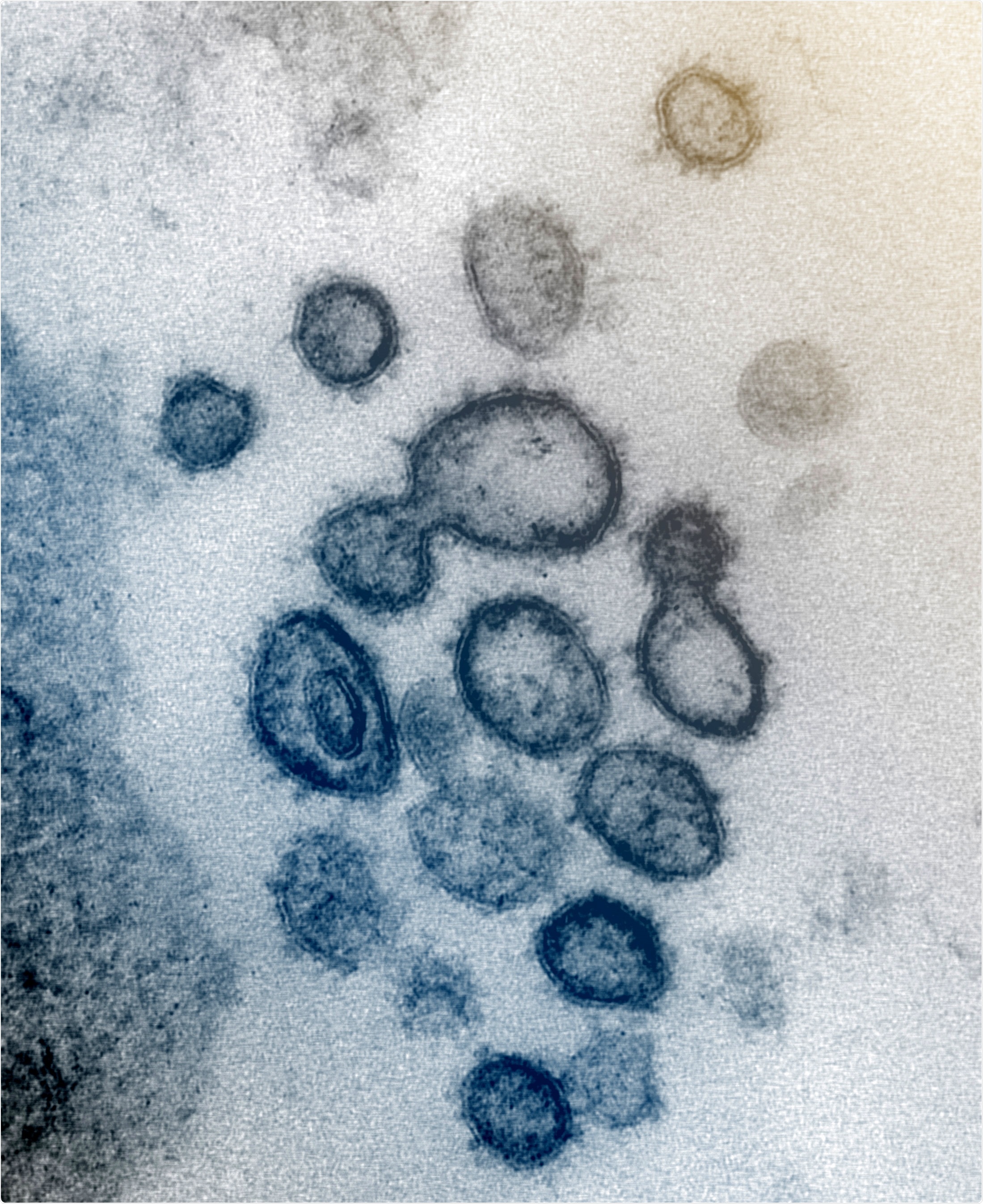 This transmission electron microscope image shows SARS-CoV-2—also known as 2019-nCoV, the virus that causes COVID-19—isolated from a patient in the U.S. Virus particles are shown emerging from the surface of cells cultured in the lab. The spikes on the outer edge of the virus particles give coronaviruses their name, crown-like.Image captured and colorized at NIAID
