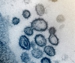 Anti-sense agents suppress SARS-CoV-2 virus
