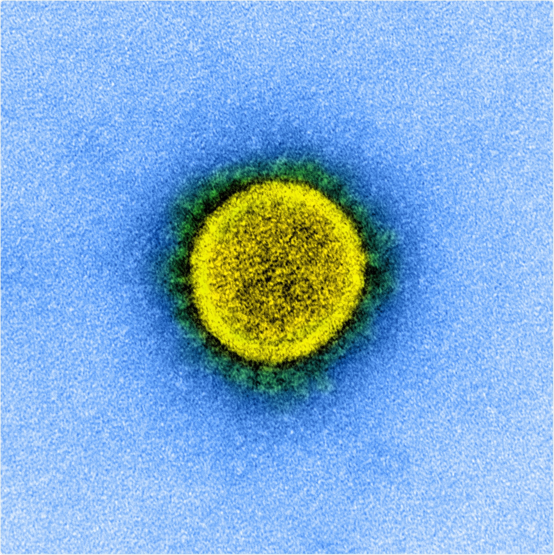 Transmission electron micrograph of a SARS-CoV-2 virus particle, isolated from a patient. Image captured and color-enhanced at the NIAID Integrated Research Facility (IRF) in Fort Detrick, Maryland. Credit: NIAID