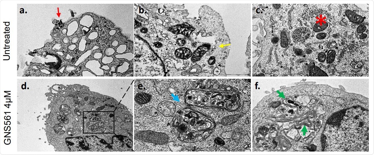GNS561 leads to autophagy blockage After 2 hours of treatment with different doses, Vero E6 cells were infected with SARS-CoV-2 IHU-MI6 strain. (A) Electron microscopy pictures illustrating infected cells without (upper panel) or with GNS5561 treatment (lower panel). The presence of the virus is indicated using a red arrow, endocytic vesicles in the cytoplasm with clathrin-coated vesicles with yellow arrows, autophagy vacuole with blue arrows and multilamellar bodies with green arrows. Vacuoles filled with nascent particles are illustrated using a red asterisk.