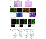 COVID-19 Shows a Loss of Bcl-6-Expressing T Follicular Helper Cells and Germinal Centers