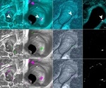 3D imaging of SARS-CoV-2 infection in ferrets using light sheet microscopy