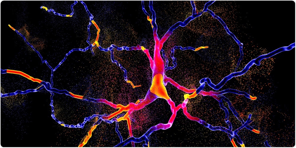 Degeneration of dopaminergic neuron
