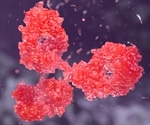 Rapid SARS‐CoV‐2 IgM‐IgG combined antibody test