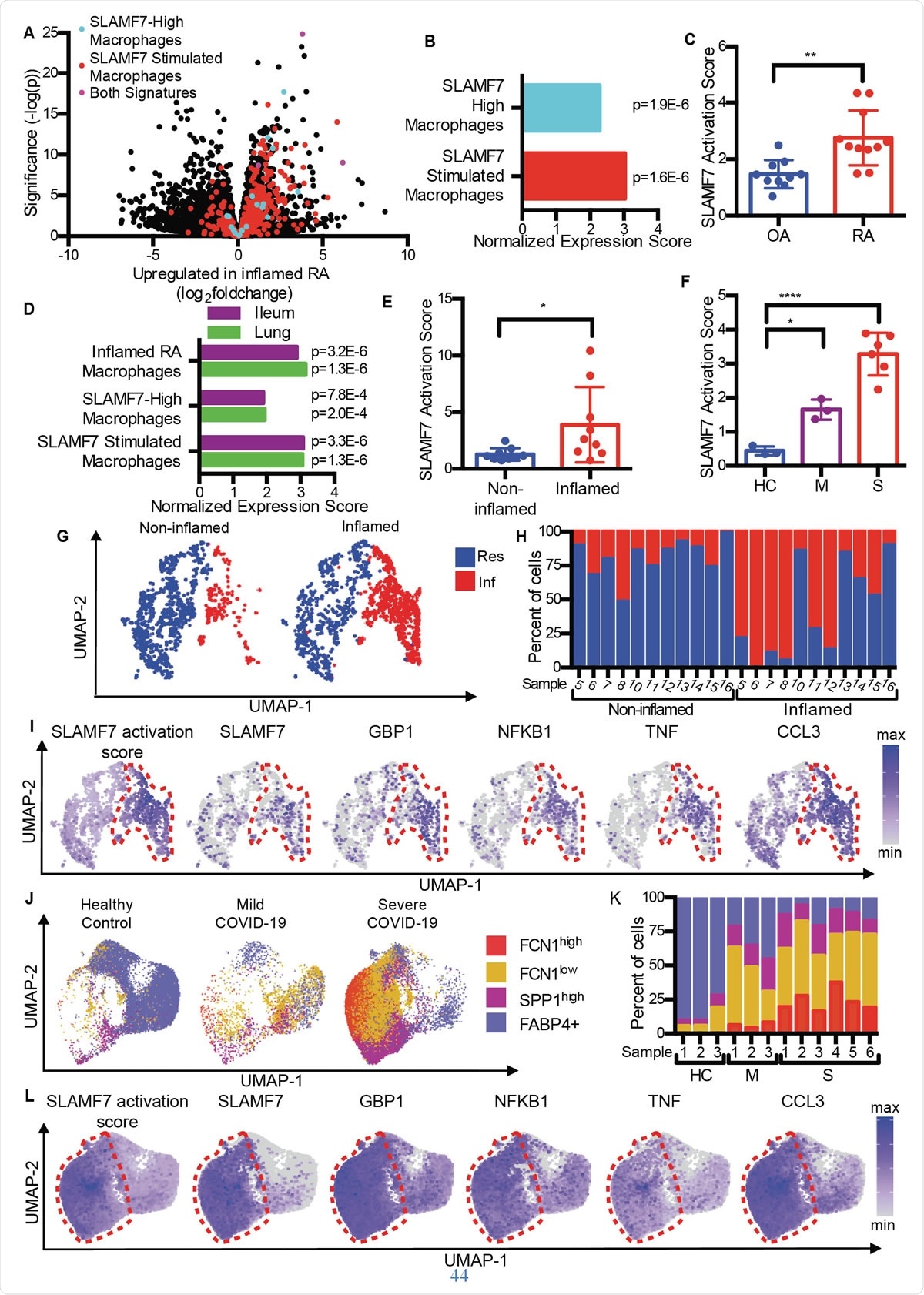 SLAMF7 super-activated macrophages drive inflammation in autoimmune and infectious disease