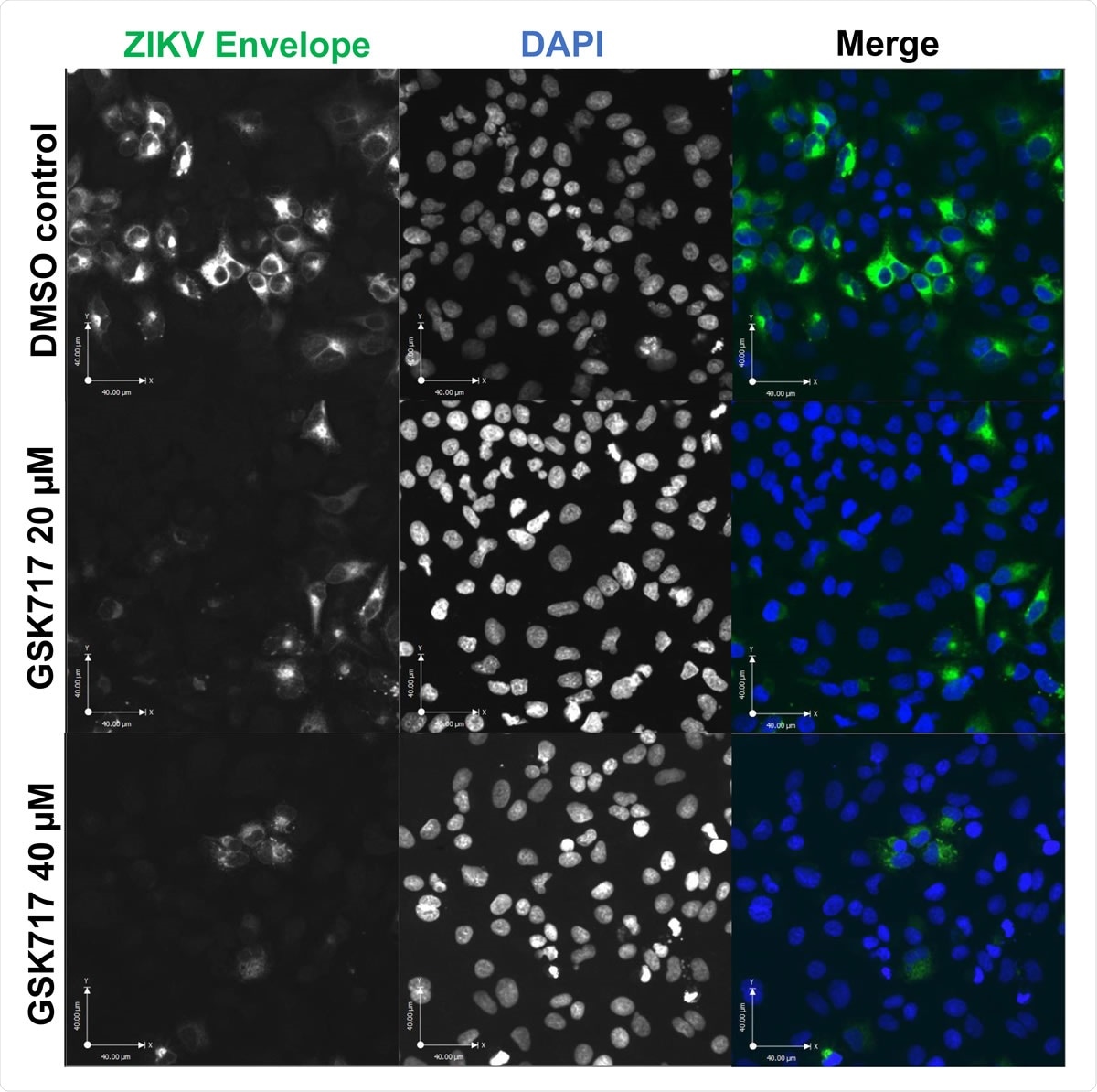 The anti-NOD2 drug GSK717 blocks the spread of ZIKV infection. (A) Representative confocal imaging (20X) showing antiviral effect of GSK717 at 20 µM and 40 µM. A549 cells were infected with ZIKV (MOI=1) followed by treatment with DMSO or GSK717 at 20 or 40 µM for 48 hours before processing for indirect immunofluorescence. ZIKV-infected cells were identified using a mouse monoclonal antibody (4G2) to envelope protein and Alexa Fluor 488 donkey anti-mouse to detect the primary antibody. Nuclei were stained with DAPI. Images were acquired using a spinning disk confocal microscope equipped with Volocity 6.2.1 software.