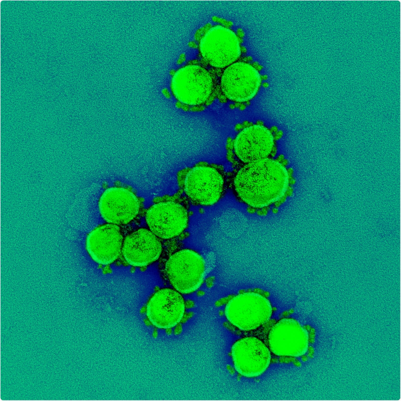 Transmission electron micrograph of SARS-CoV-2 virus particles, isolated from a patient. Image captured and color-enhanced at the NIAID Integrated Research Facility (IRF) in Fort Detrick, Maryland. Credit: NIAID