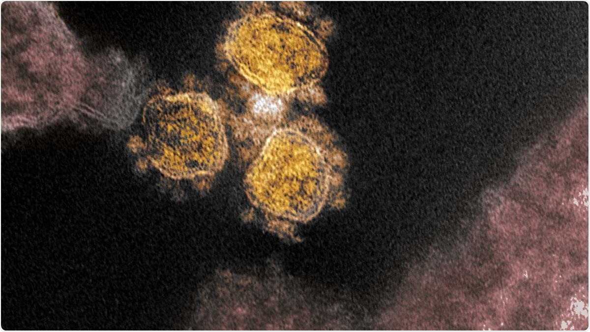 Study: Nanobodies: an unexplored opportunity to combat COVID-19. Image Credit: NIAID