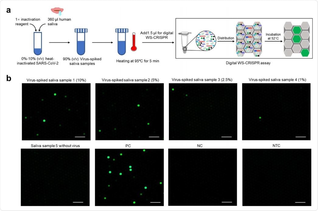 Direct detection of SARS-CoV-2 in crude saliva samples by digital WS-CRISPR assay. a, Workflow for direct SARS-CoV-2 testing in spiked saliva samples by digital WS-CRISPR assay. b, Endpoint fluorescence micrographs of the chip for direct detection of SARS-CoV-2 virus spiked in saliva samples. Saliva samples 1-5, the samples with 10%, 5%, 2.5%, 1%, and 0% of heat-inactivated SARS-CoV-2 virus. Each micrograph is a representative of six distinct regions taken to cover about 2809 microreactions. PC, SARS-CoV-2-positive control sample. NC, SARS-CoV-2-negative control sample. NTC, non-template control. Scale bars are 300 μm.