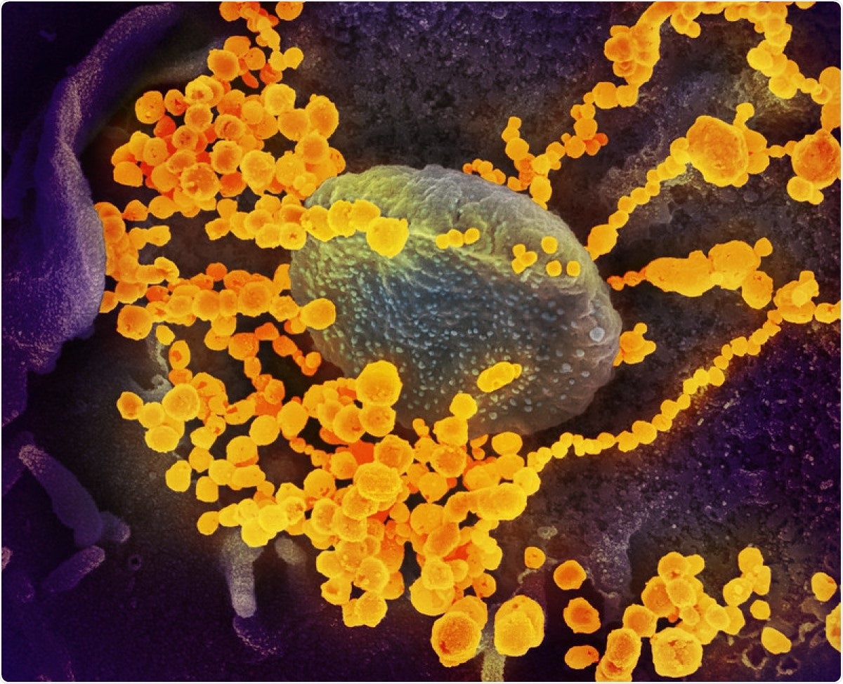 This scanning electron microscope image shows SARS-CoV-2 (round gold objects) emerging from the surface of cells cultured in the lab. SARS-CoV-2, also known as 2019-nCoV, is the virus that causes COVID-19. The virus shown was isolated from a patient in the U.S. Image captured and colorized at NIAID