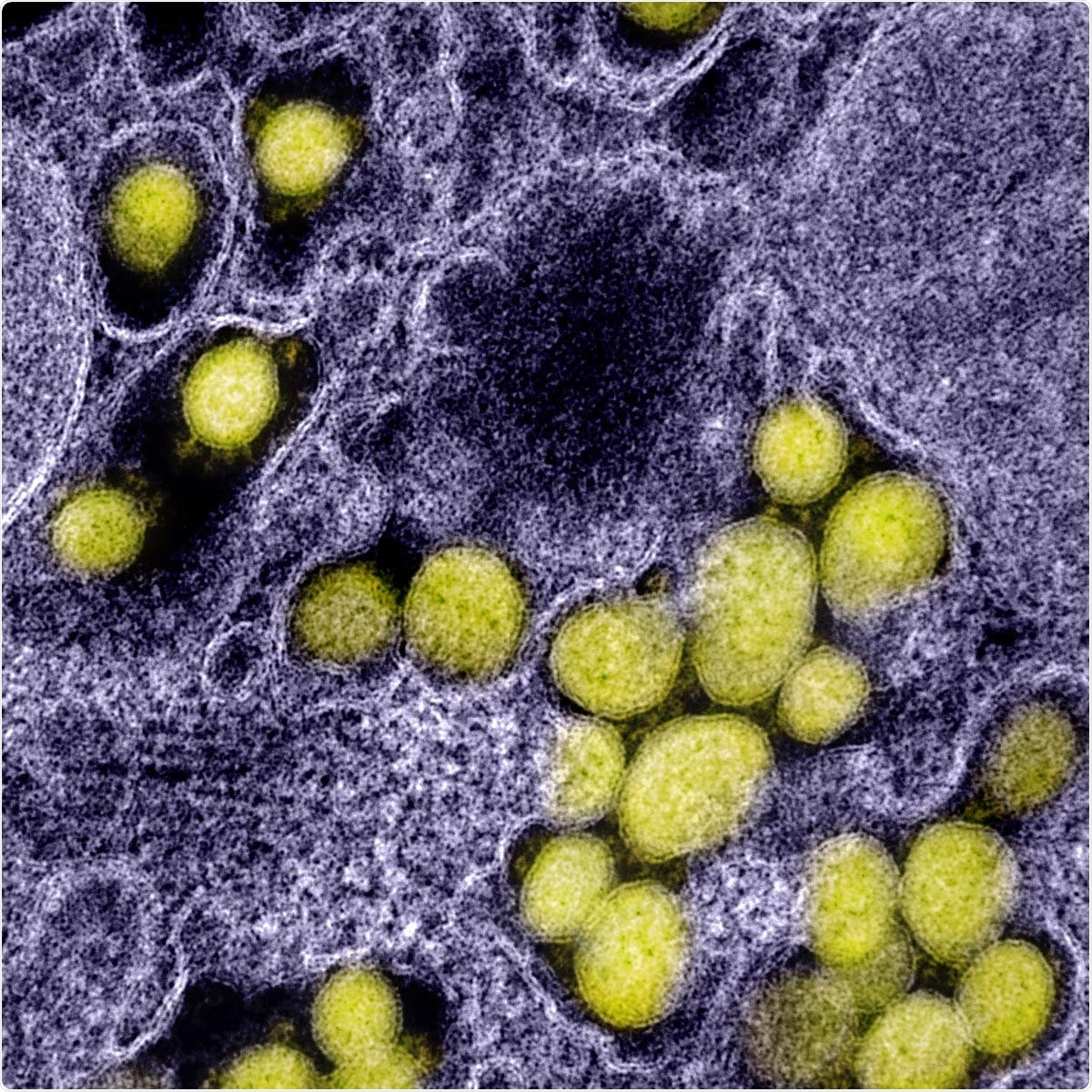 Study: Rapid feedback on hospital onset SARS-CoV-2 infections combining epidemiological and sequencing data. Transmission electron micrograph of SARS-CoV-2 virus particles, isolated from a patient. Image captured and color-enhanced at the NIAID Integrated Research Facility (IRF) in Fort Detrick, Maryland. Image Credit: NIAID / Flickr