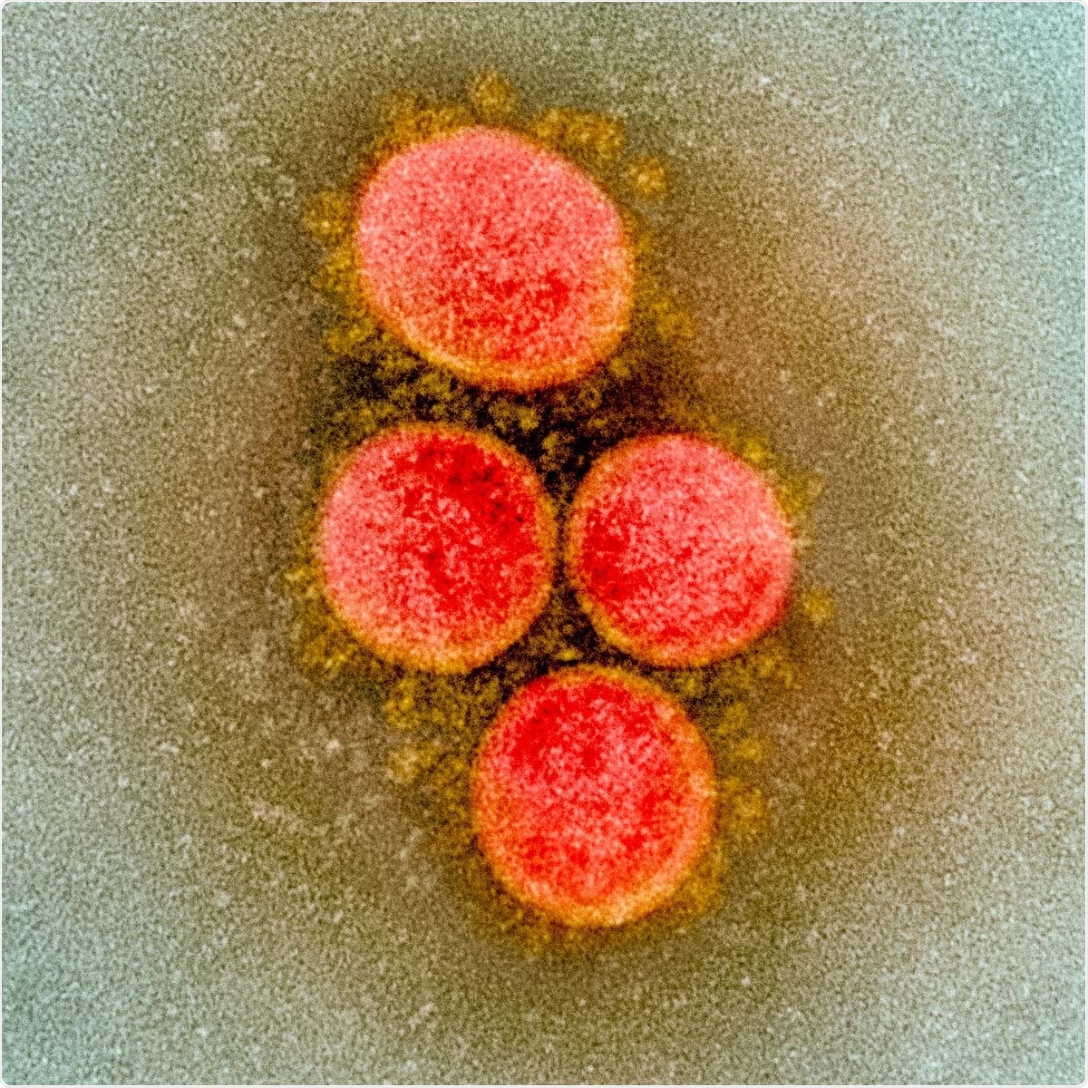 Transmission electron micrograph of SARS-CoV-2 virus particles, isolated from a patient. Image captured and color-enhanced at the NIAID Integrated Research Facility (IRF) in Fort Detrick, Maryland. Image Credit: NIAID / Flickr