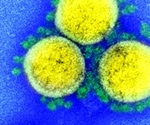 How SARS-CoV-2 blocks immune response
