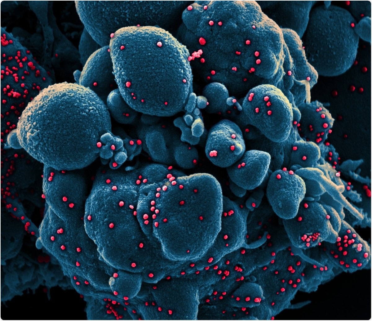 Novel Coronavirus SARS-CoV-2 Colorized scanning electron micrograph of an apoptotic cell (blue) infected with SARS-COV-2 virus particles (red), isolated from a patient sample. Image captured at the NIAID Integrated Research Facility (IRF) in Fort Detrick, Maryland. Image Credit: NIAID / Flickr