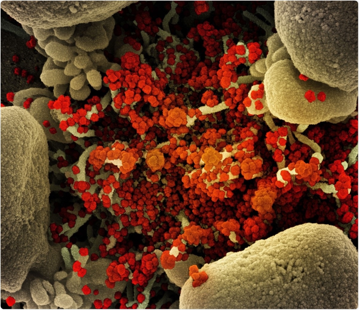 Colorized scanning electron micrograph of an apoptotic cell (tan) heavily infected with SARS-CoV-2 virus particles (orange), isolated from a patient sample. Image captured at the NIAID Integrated Research Facility (IRF) in Fort Detrick, Maryland. Image Credit: NIAID / Flickr