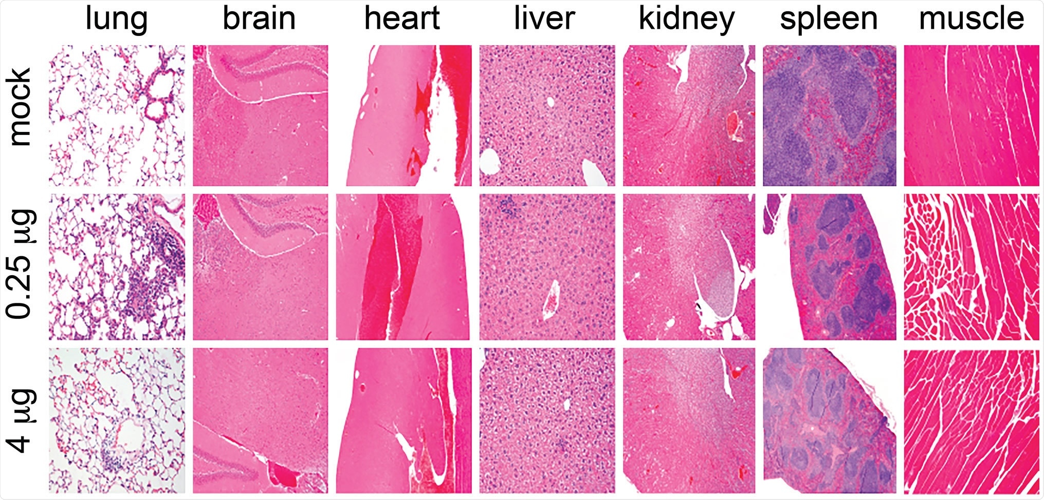 Absence of tissue pathology upon LSNME/SW1 vaccination. Representative micrographs from histological analysis (hematoxylin and eosin stain) of lung, brain, heart, liver, kidney, spleen, and muscle (side of injection) of animals from (upper row) control mice, (middle row) mice immunized with the lower dose of the LSNME/SW1 vaccine, and (lower row) mice immunized with the higher dose of the LSNME/SW1 vaccine.