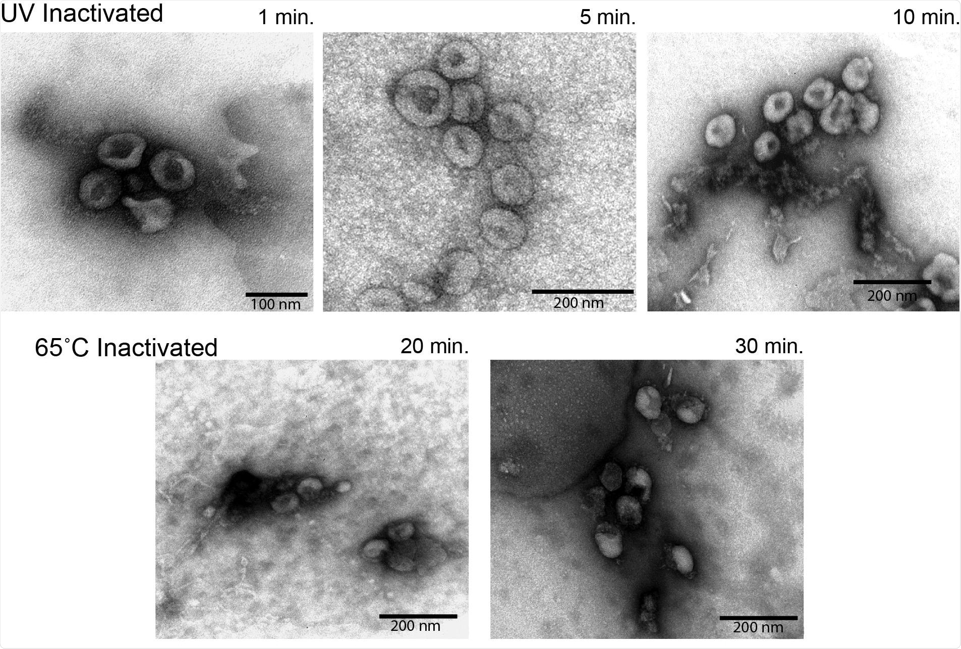 Electron microscopy analysis of virion morphology Semi-purified virion preparations were spotted onto a grid and imaged to assess virion morphology. The top row of images was taken from UV inactivated samples. The bottom row of images was taken from heat inactivated samples. Relative size is indicated by the scale bar in the lower corner of each image.