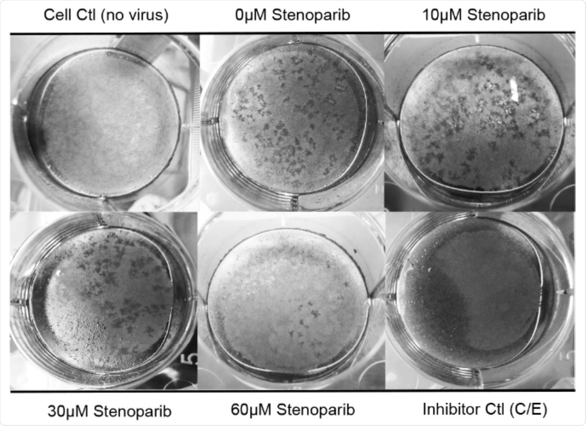 Stenoparib inhibits plaque formation in Calu-3 cells. Plaque assays were performed using Calu-3 cells infected with SARS-CoV-2 and treated with varying concentrations of stenoparib. Plaques are identified as empty regions or “dead zones” in the cellular monolayer and are expressed as plaque forming units (PFUs) per well. Plaques were manually counted and averaged among experimental replicates. This score is normalized as a percentage of untreated, but infected cells. In this representative image of the SARS-CoV-2/Calu-3 experiment, plaques are dark scars on the cellular monolayer. Controls were 1) uninfected cells (Cell Ctl), 2) untreated, but infected cells (0 μM), and 3) a camostat mesylate and E64d (C/E) inhibitor control (Inhibitor Ctl). Treatment with stenoparib at 10 μM and 30 μM led to a marked reduction in plaquing efficiency, whereas 60 μM resulted in near complete inhibition.