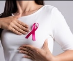 Deep learning helps determine a woman’s risk of breast cancer