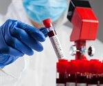 Seroprevalence meta-analysis predicts 643 million already infected by SARS-CoV-2 globally