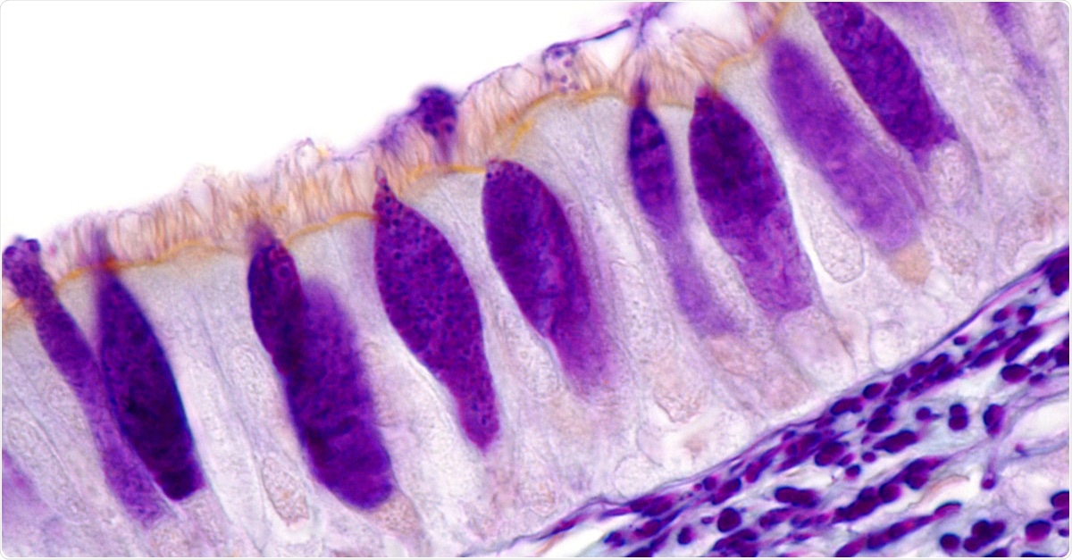 Study: Goblet Cell Hyperplasia Increases SARS-CoV-2 Infection in COPD. Image of Goblet cells in the ciliated respiratory epithelium of the trachea, with their mucus stained in violet color. Elastic fibers located under the epithelium are also stained. Light microscope picture. Image Credit: Jose Luis Calvo / Shutterstock