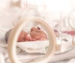 Babies born early face an increased risk of childhood hospitalization