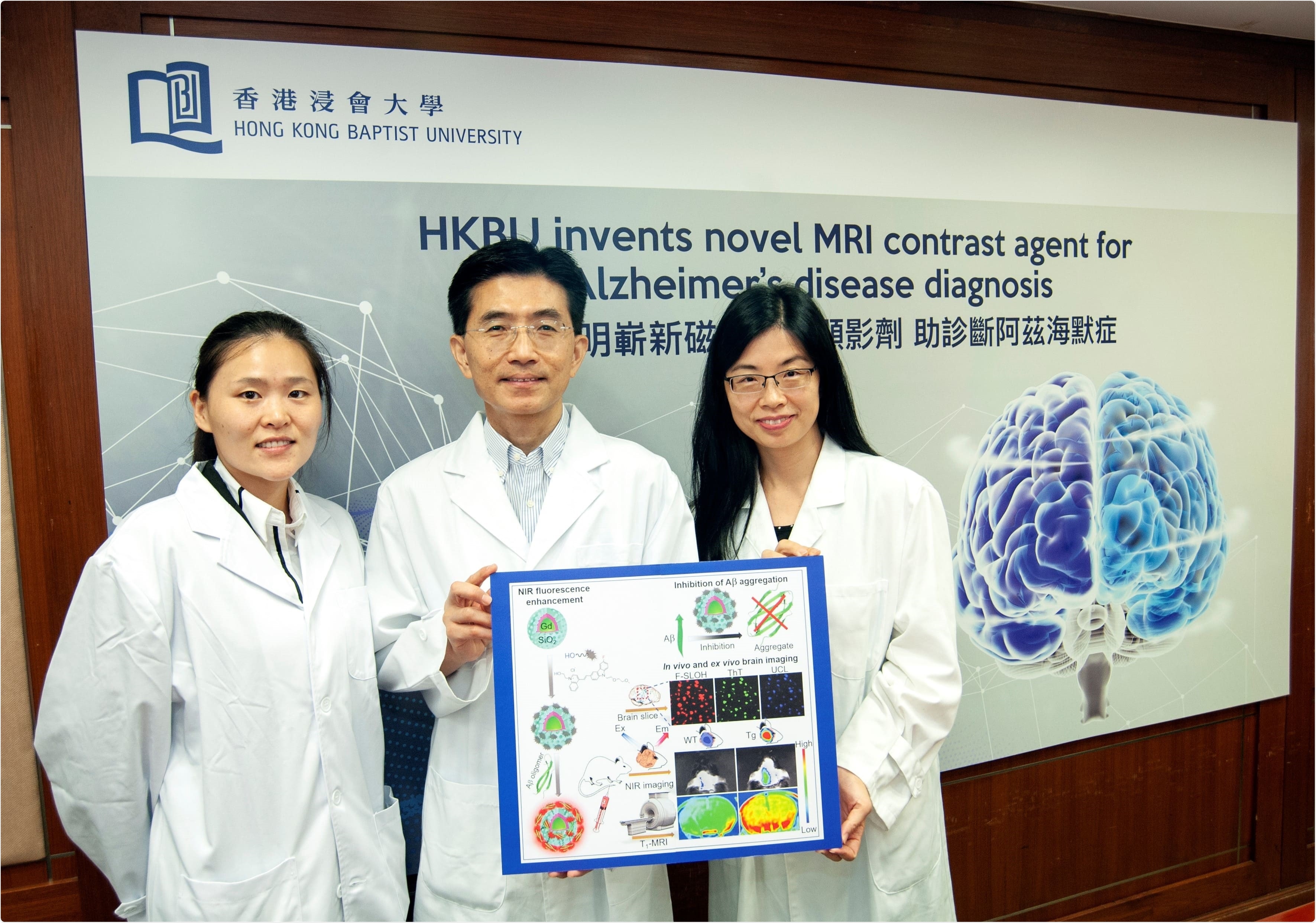 Novel MRI contrast agent offers hope for early detection of Alzheimer’s disease