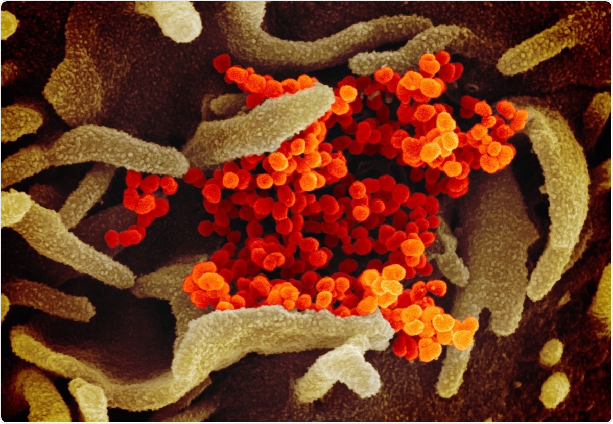 Novel Coronavirus SARS-CoV-2. This scanning electron microscope image shows SARS-CoV-2 (orange)—also known as 2019-nCoV, the virus that causes COVID-19—isolated from a patient in the U.S., emerging from the surface of cells (green) cultured in the lab. Image captured and colorized at NIAID
