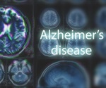 A new potential therapy for Alzheimer's disease