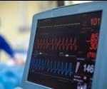 COVID-19 impacts cardiac care in the United Kingdom